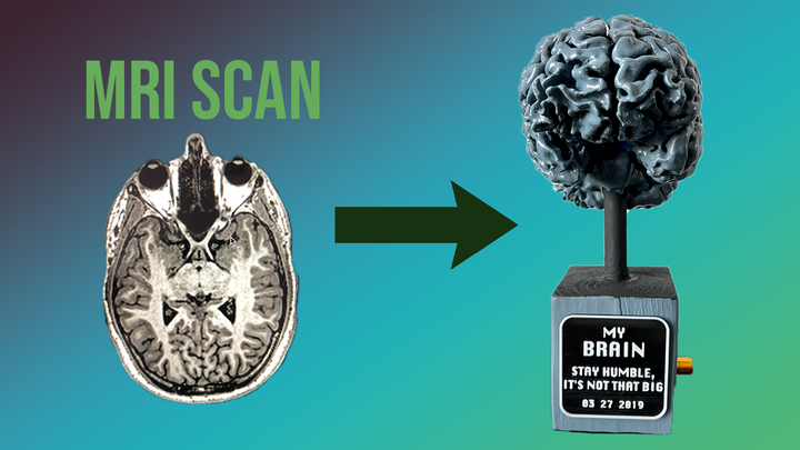 mri scan brain 3d